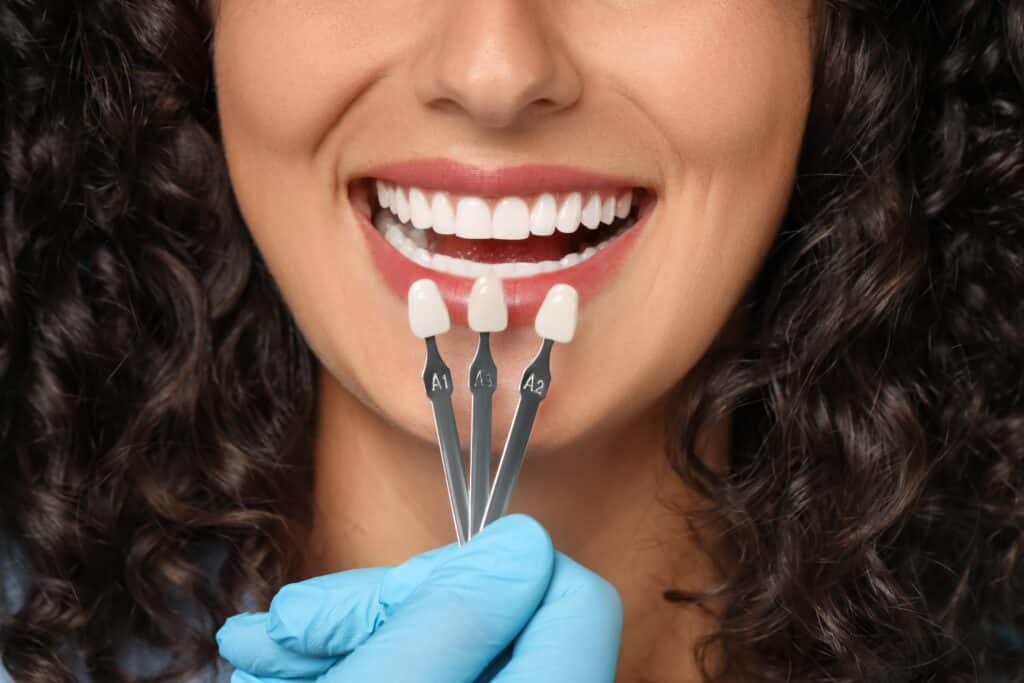 Dental Implants Vancouver