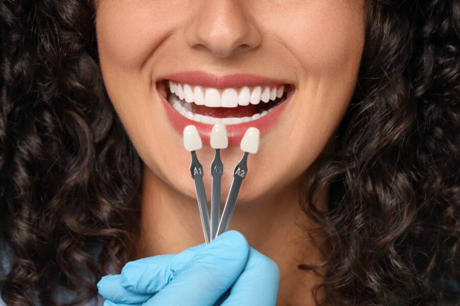 Dental Implants Vancouver